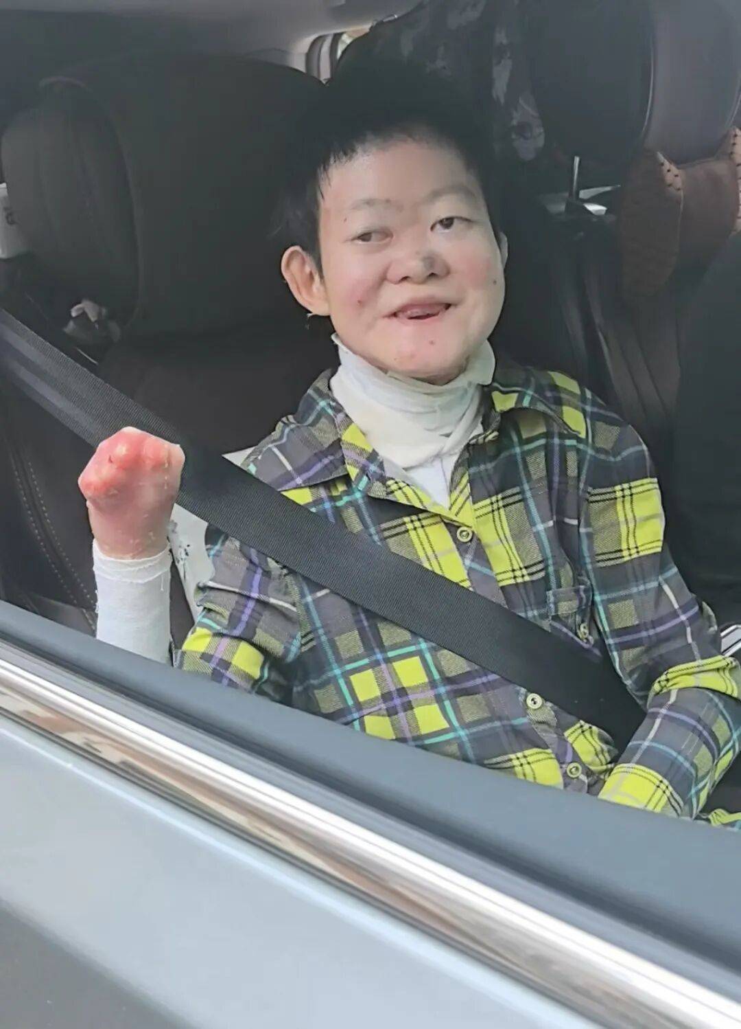 醫(yī)生斷言“活不過2歲”的鄭州罕見病女孩，24歲“帶傷出征”，開啟西藏之行:機(jī)械制造